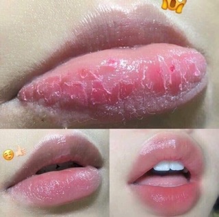 Ủ Môi Laneige