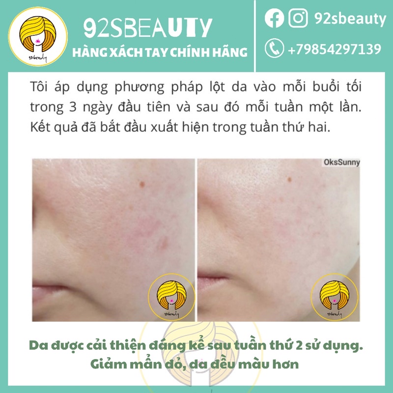 Tẩy da chết hoá học Teana Blue Retinol Rejuvenating Peel cho da căng bóng, láng mướt, giảm mụn