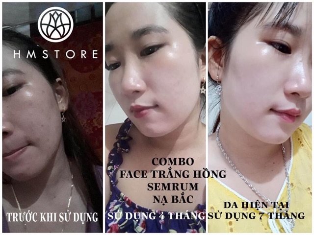 Kem fa.ce trắng hồng