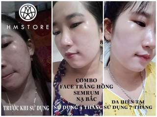 Kem fa.ce trắng hồng