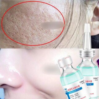 Tinh chất dưỡng shrinkage pore