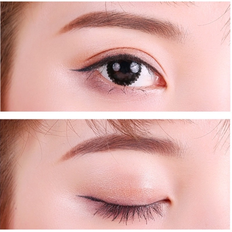 Kích mí lưới cuộn