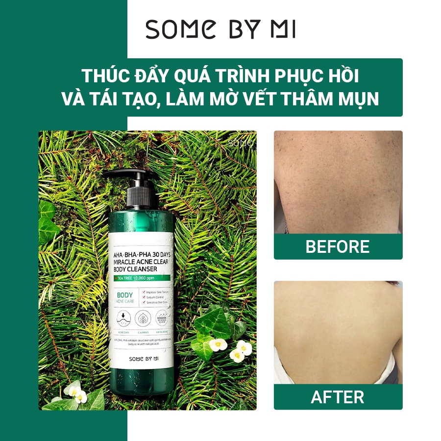 Sữa Tắm Làm Giảm Mụn SOME BY MI AHA-BHA-PHA 30 Days Miracle Acne Clear Body Cleanser 400g