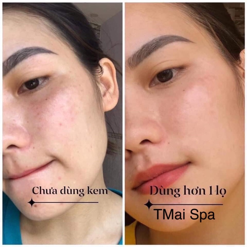 Kem dưỡng da tái tạo đông y MH ⚡ MẪU MỚI ⚡ kem dưỡng tái tảo da nhẹ nhàng đào thải các tế bào chết hiệu quả