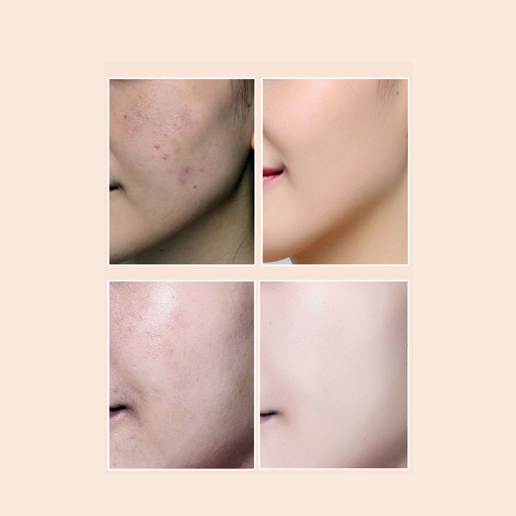 Kem Nền Trang Điểm Che Khuyết Điểm BB Cream Lameila Perfect Repair Light Concealer Foundation | BigBuy360 - bigbuy360.vn