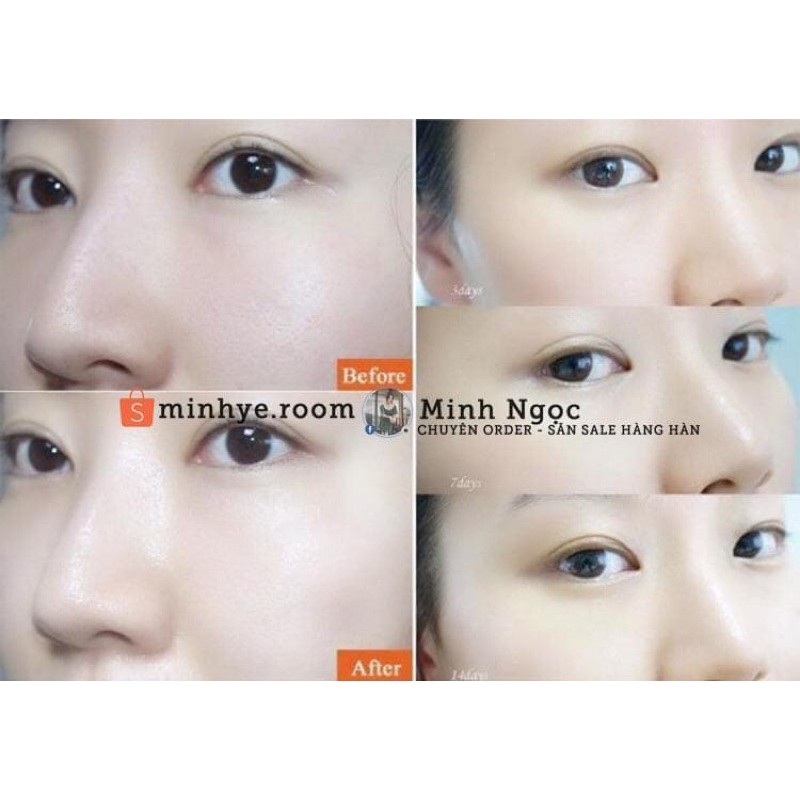 Viên Uống Collagen, Viên Uống Trắng Da Nutri D Day Premium Trẻ Hóa Trắng Sáng Căng Bóng Bật Tone Từ Face Đến Body | BigBuy360 - bigbuy360.vn