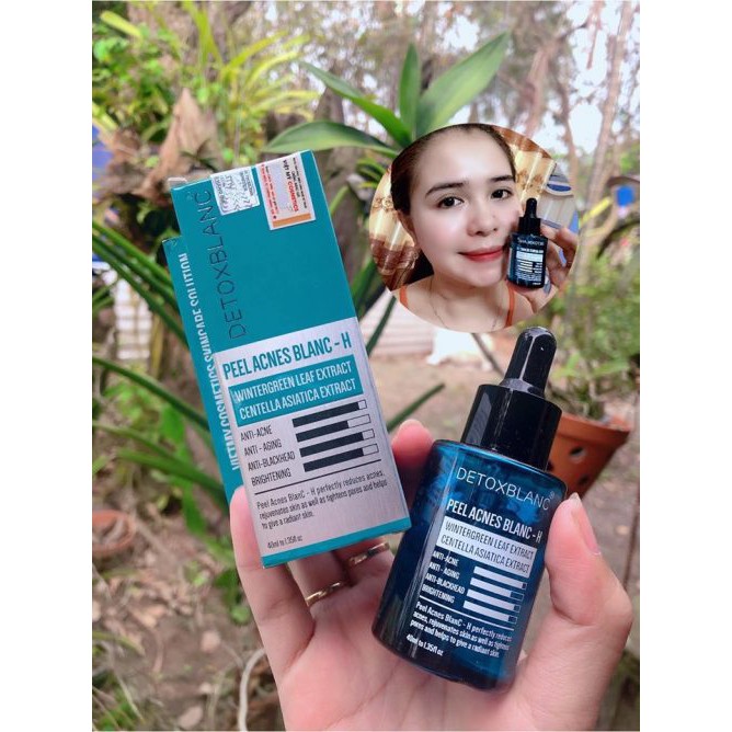 SERUM MỤN DETOX BLANC (Mẫu mới 2020 Của Detox Blanc Số 13) | BigBuy360 - bigbuy360.vn