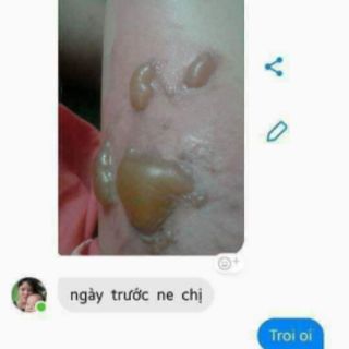 Mỡ trăn nguyên chất N'Store