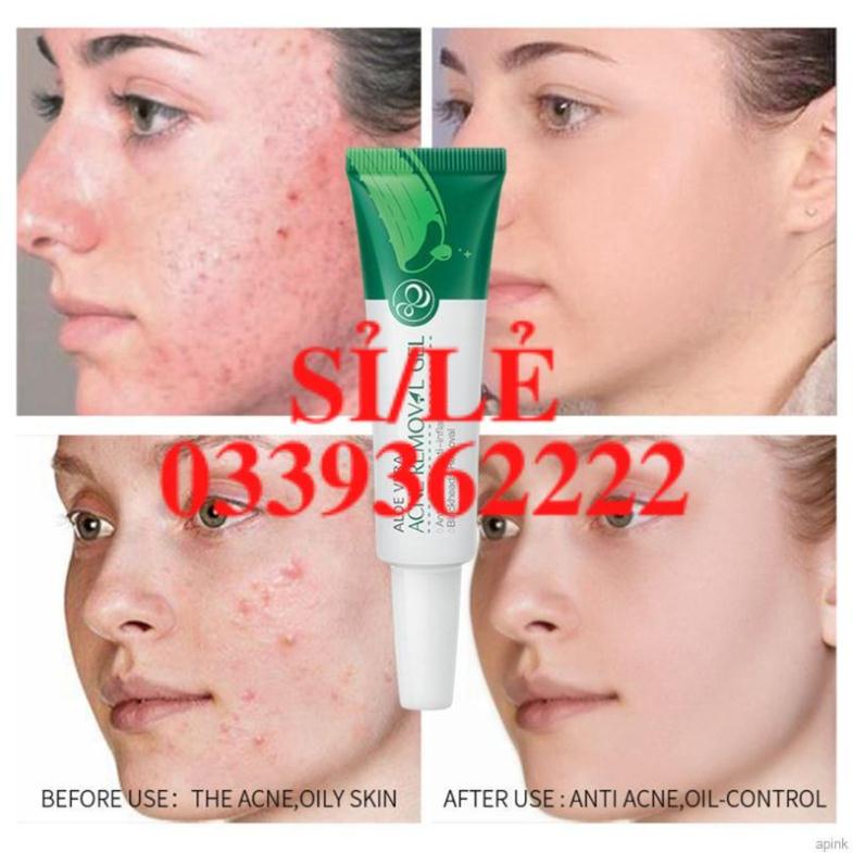 [Hàng mới về] Gel Lô Hội Laikou Giúp Dưỡng Ẩm Và Phục Hồi Da 20g