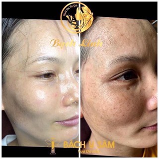 Bạch Linh 3_Bách Y Sâm 03 Chuyên Nám (Mẫu Mới) .