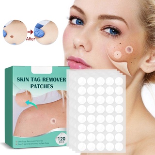 Bộ 120 miếng dán loại bỏ mụn cóc nốt ruồi
