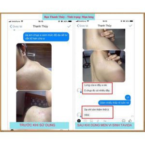 MEN VI SINH TAVIDA HẾT MỤN LƯNG, VIÊM NANG LÔNG, MẨN NGỨA