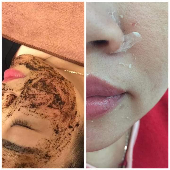 (Tặng kem serum sữa căng bóng) 𝐕𝐈 𝐊𝐈𝐌 𝐓𝐇𝐀̉𝐎 𝐃𝐔̛𝐎̛̣𝐂 TÁI TẠO DA thế hệ mới căng bóng, se lỗ chân lông, trắng sáng p