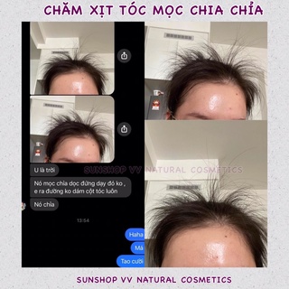 Xịt thảo dược kích mọc tóc VV NATURAL , ngăn rụng tóc, dài tóc nhanh nuôi dưỡng tóc hiệu quả