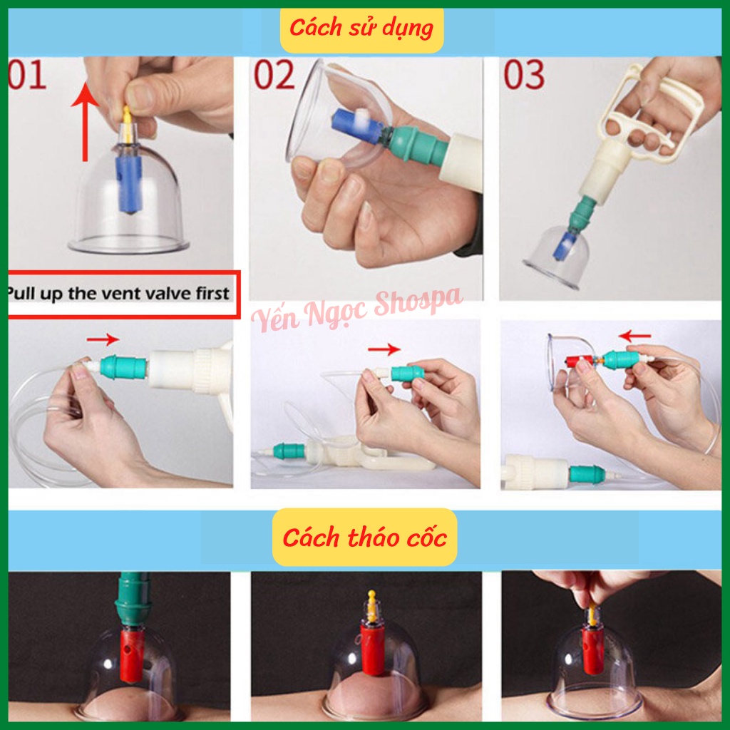 Bộ giác hơi không dùng lửa 24 cốc đủ phụ kiện