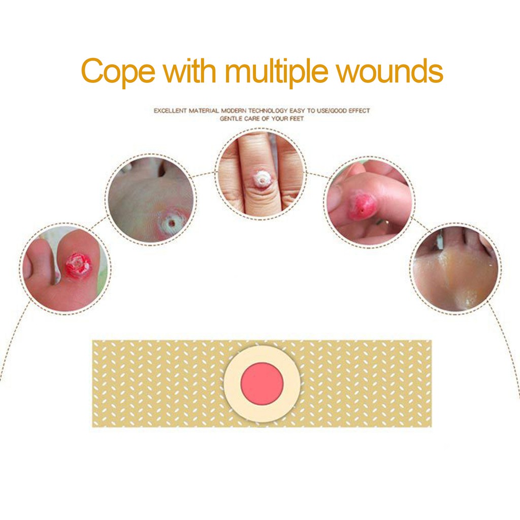 (Hàng Mới Về) Bộ 42 Miếng Dán Trị Mụn Cóc Chất Lượng Cao | BigBuy360 - bigbuy360.vn