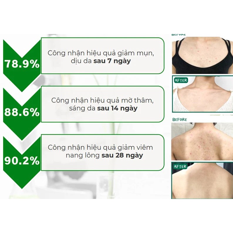 Xịt Toàn Thân Giảm Mụn, Mờ Thâm, Giảm Viêm Nang Lông Derladie Herbal Extract Body Solution Mist 150ml