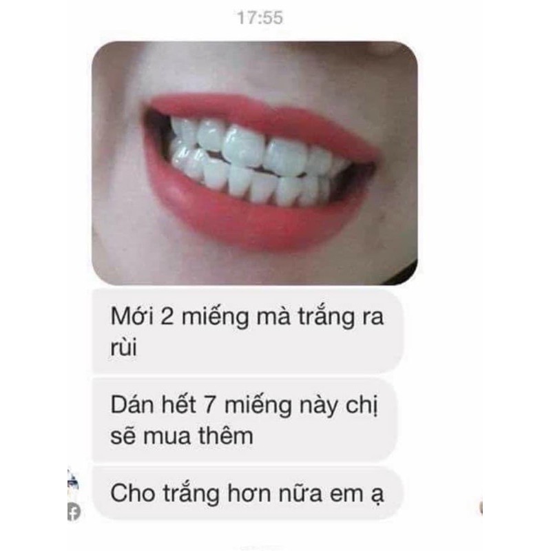 Miếng dán trắng răng Crest 3D Professional White