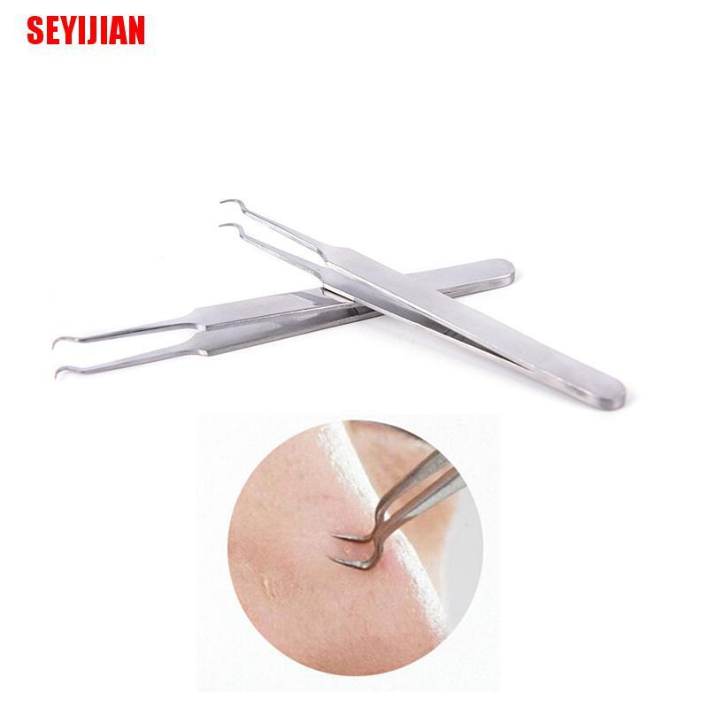 Dụng Cụ Nặn Mụn Đầu Đen Làm Sạch Da Mặt Tiện Dụng
