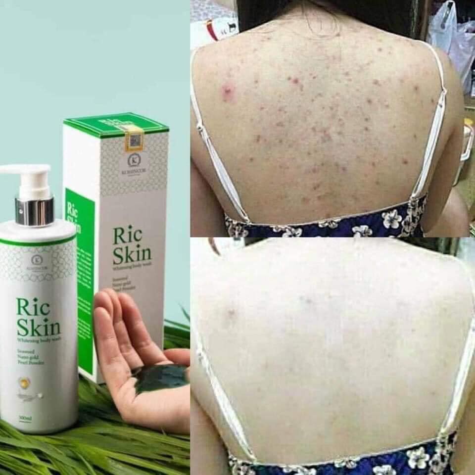 Sữa tắm ricskin kohinoor chính hãng 100%