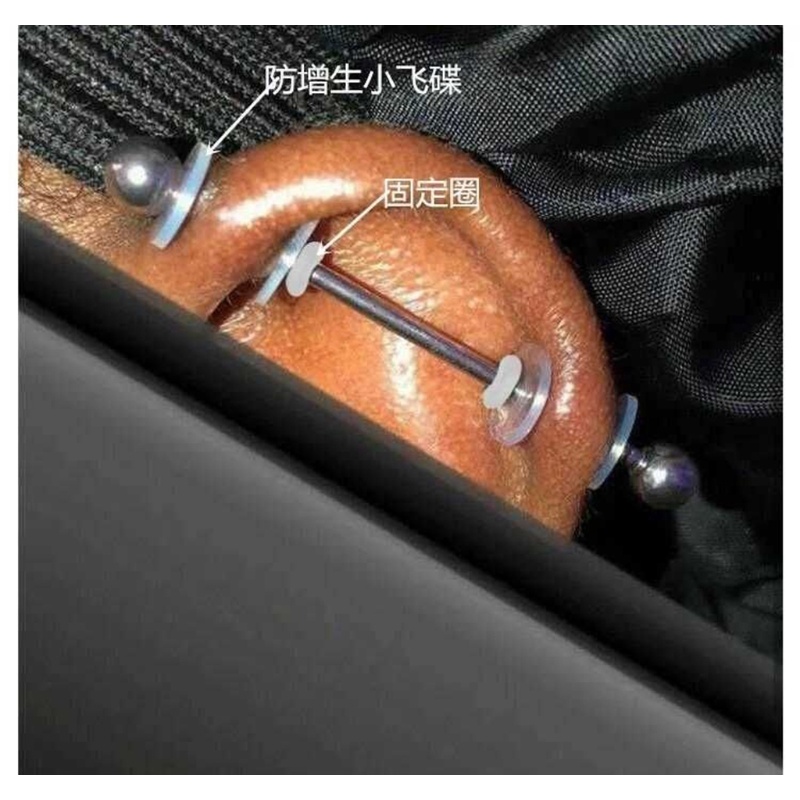 Sa Khuyên Xỏ Tai Chống Ngứa Và Kích Ứng Da