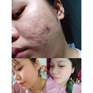 Sâm tái tạo đông y Hạnh Sinoo