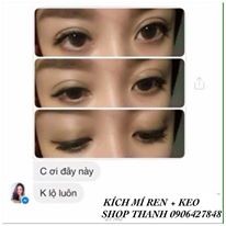 LƯỚI REN KÍCH MÍ TÀN HÌNH + KEO