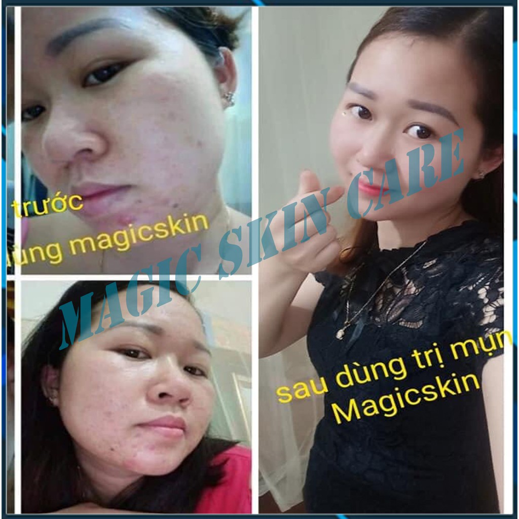 [ HÀNG CHÍNH HÃNG ] Serum trị mụn  Sake Acnes Liquid Magic Skin | BigBuy360 - bigbuy360.vn