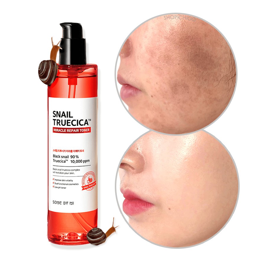 Nước Hoa Hồng Làm Dịu Da Some By Mi Snail Truecica Miracle Repair Toner