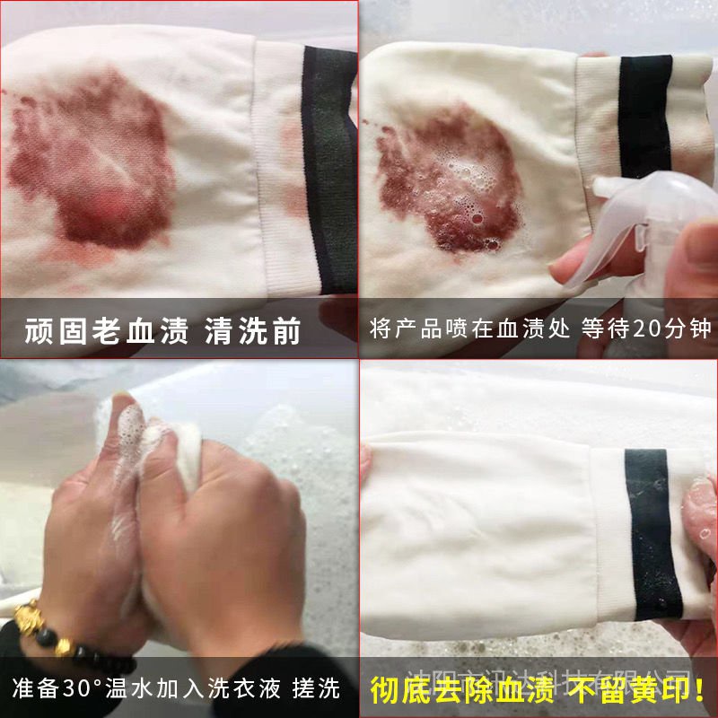 Chất Tẩy Vết Bẩn Vết Máu Chuyên Dụng Làm Sạch Vết Bẩn Trên Giường Cho Nữ