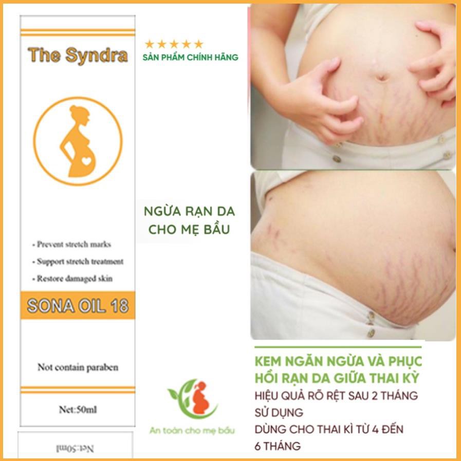 Dầu rạn da cho bà bầu - Dưỡng ẩm cho da khô, chống nứt nẻ, rạn da | BigBuy360 - bigbuy360.vn