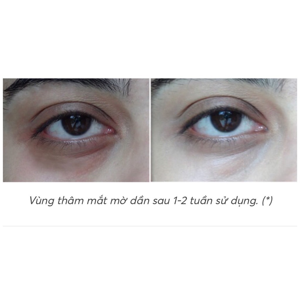 Kem THÂM QUẦNG MẮT Kumargic Eye Nhật Bản 20g mờ thâm quầng mắt, bọng mắt, giảm nếp nhăn, vết chân chim . | BigBuy360 - bigbuy360.vn