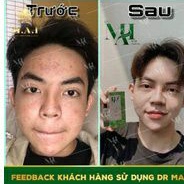(TẶNG MIẾNG DÁN LỘT MỤN ĐẦU ĐEN) serum Tri mun thảo mộc Mai dùng cho mọi lứa tuổi an toàn cho cả mẹ bầu | BigBuy360 - bigbuy360.vn