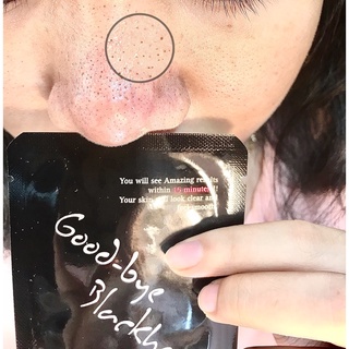 Miếng đẩy mụn đầu đen Goodbye Blackhead Ciracle