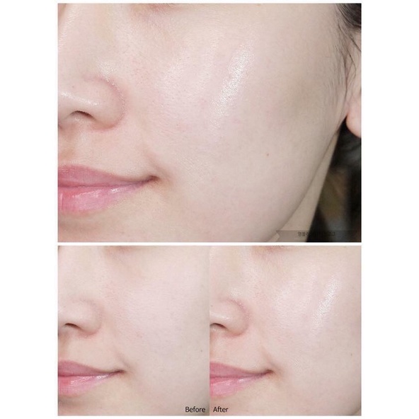 Tinh chất cấp nước Sur.Medic Super Hyaluronic 100TM Aqua Ampoule