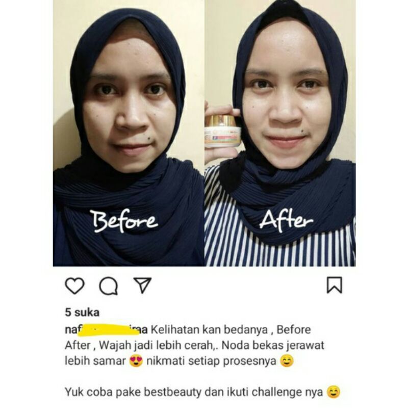 Bán chạy nhất Túi đựng đồ đẹp cuối cùng | BigBuy360 - bigbuy360.vn