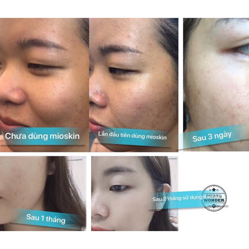 Xịt dưỡng serum Tế bào gốc Mioskin 5 in 1 | BigBuy360 - bigbuy360.vn