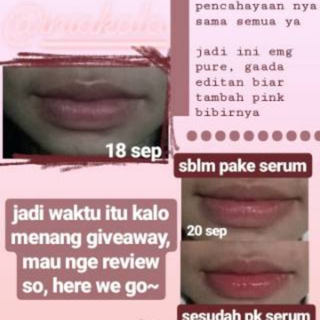 (Hàng Mới Về) Serum Dưỡng Môi 7 Ngày Thành Phần Tự Nhiên | BigBuy360 - bigbuy360.vn