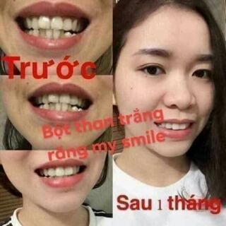 trắng răng than hoạt tính