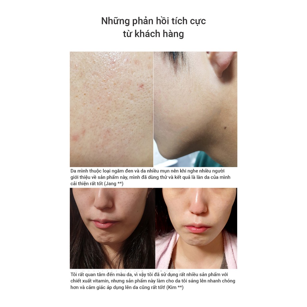 Nước Hoa Hồng Dưỡng Trắng Da SKINMISO PURE VITAMIN-C TONER_Mỹ phẩm Hàn Quốc chính hãng