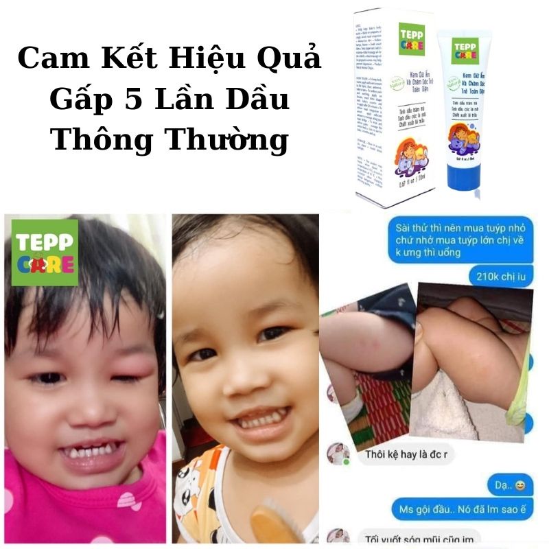 Kem Giữ Ấm Tepp Care 20ml, Dưỡng Da, Giữ Ấm Cơ Thể Cho Bé, KHÔNG Cay Nóng, 100% Thiên Nhiên.