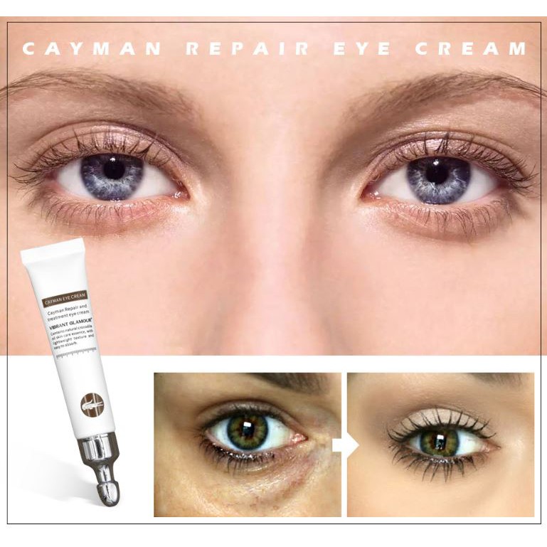 Kem làm mờ quầng thâm - bọng mắt - vết nhăn Cayman Eye Cream Vibrant Glamour EN