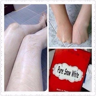Tắm Trắng Pure Snow White