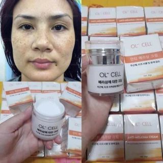 OL-CELL hút nám tàn nhang chính hãng