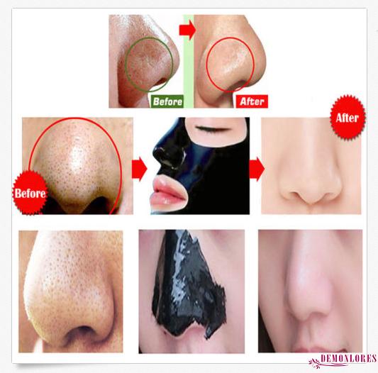 [Hàng mới về] Mặt nạ lột mụn đầu đen làm sạch sâu và se lỗ chân lông hiệu quả