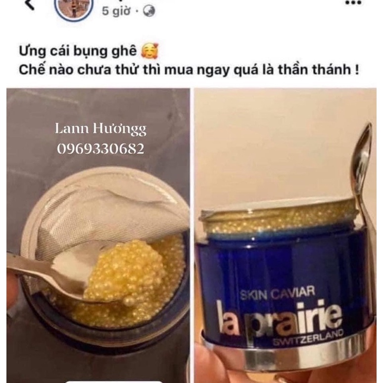 𝐊𝐞𝐦 𝐭𝐫ứ𝐧𝐠 𝐜𝐚́ 𝐋𝐚 𝐏𝐫𝐚𝐢𝐫𝐢𝐞 𝐒𝐤𝐢𝐧 𝐂𝐚𝐯𝐢𝐚𝐫