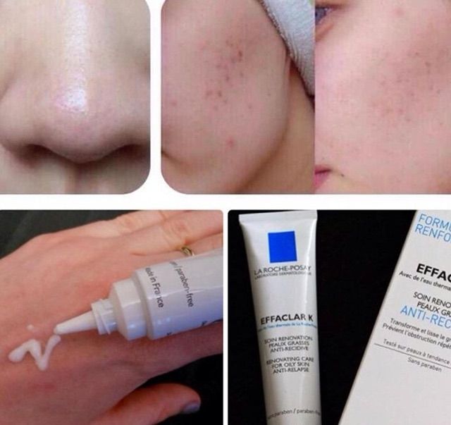 Kem dưỡng giảm mụn Duo+ 40ml La roche posay | BigBuy360 - bigbuy360.vn