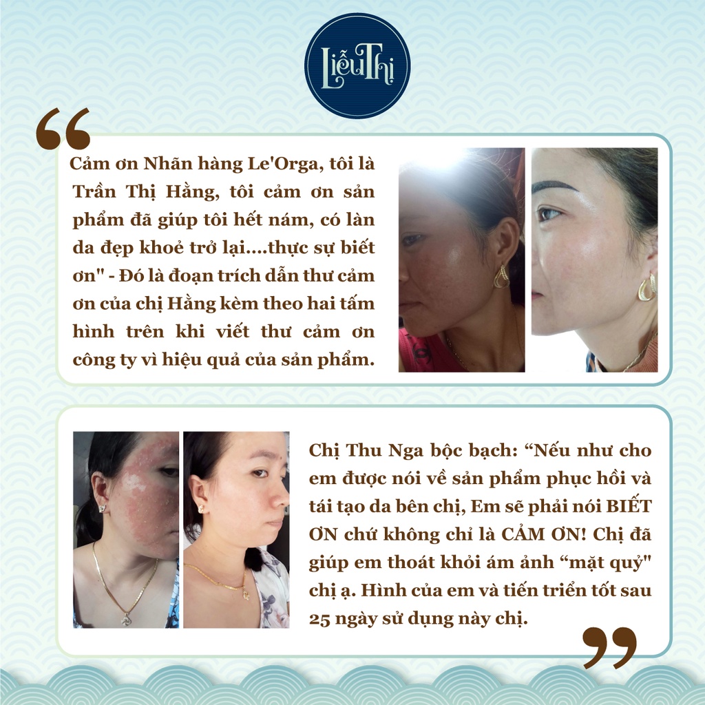 Serum Trắng Da Trị Nám Detox White - Tinh Chất Trẻ Hóa Da Tăng Độ Ẩm Huyết Thanh Giảm Lão Hóa Le'Orga 7ml | BigBuy360 - bigbuy360.vn