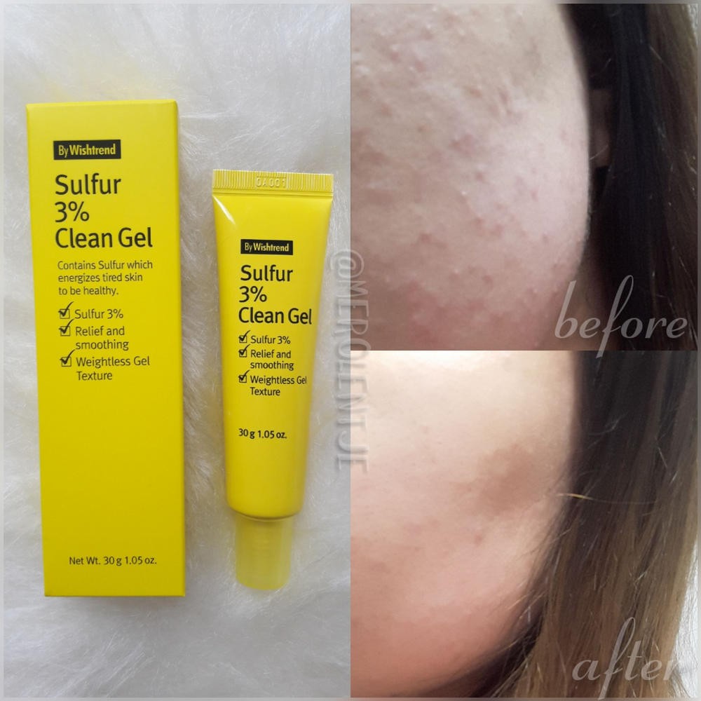 Gel hỗ trợ giảm mụn và ngăn ngừa mụn By Wishtrend Sulfur 3% Clean Gel 30g _ By Wishtrend Chính Hãng