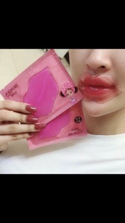 Mặt nạ môi